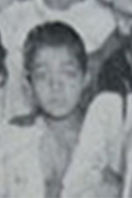 Синдроме де Пâницо