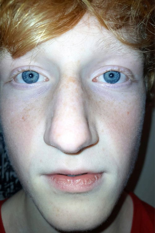 Цхарлие стуббс