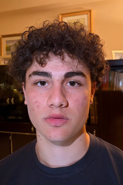 Томмасо Сцхисано