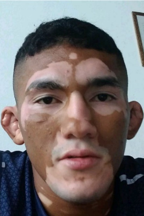 Мелqуизаел Цоста