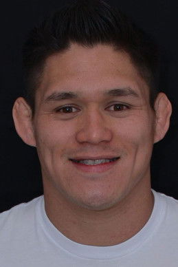 Херман Террадо