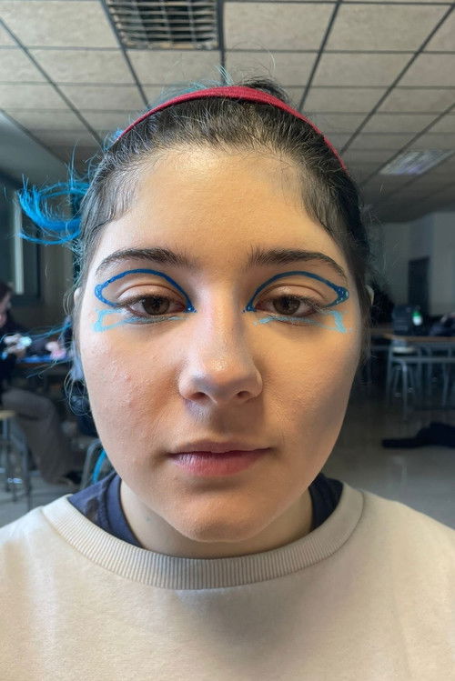 Схио Йерпес