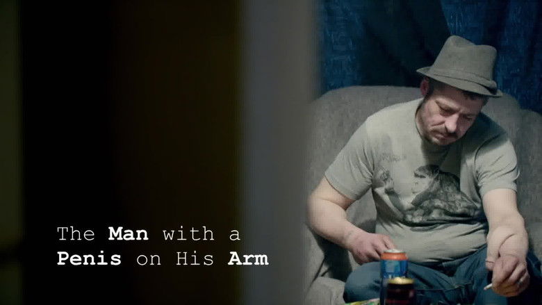 The Man With a Penis on His Arm