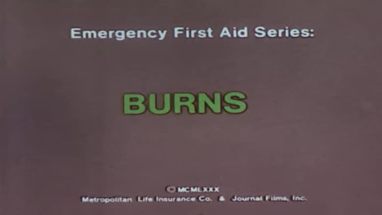 Emergency First Aid Series: Burns