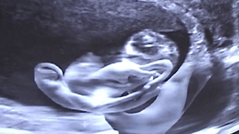 кадр из фильма Castration Movie Anthology iii. Year of the Hyaena