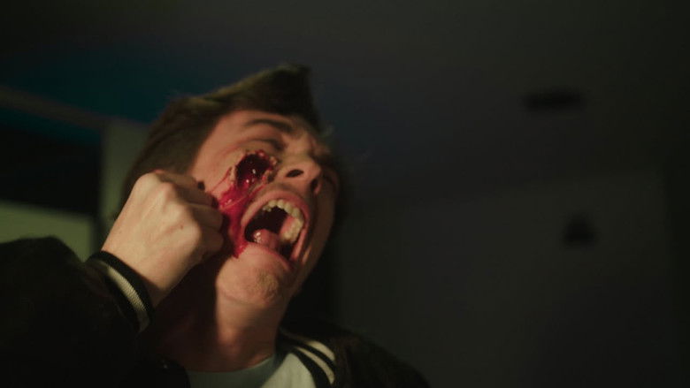 кадр из фильма Pimple Patch