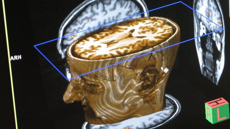 кадр из фильма Journey Into Dyslexia