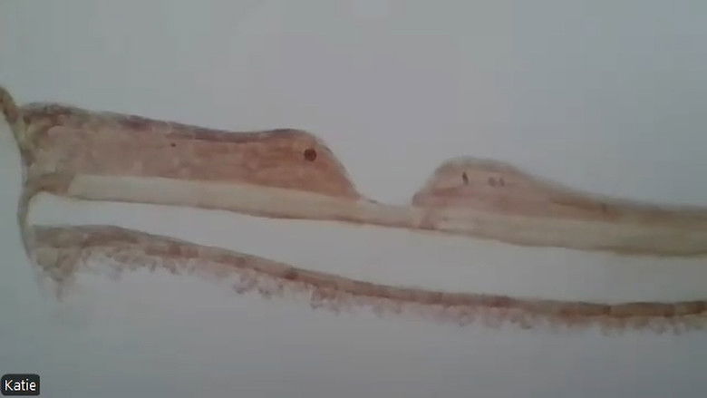 кадр из фильма My Schizoaffective Documentary