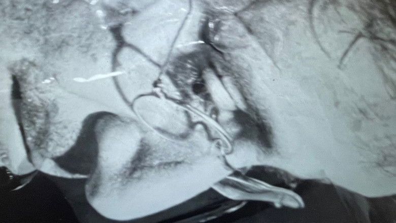 кадр из фильма פרנהיים