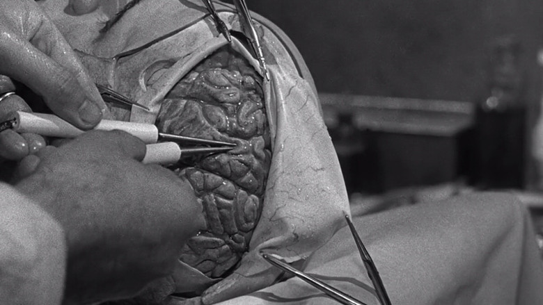 кадр из фильма The Brain That Wouldn't Die