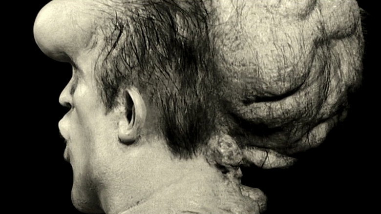Joseph Merrick: The Real Elephant Man