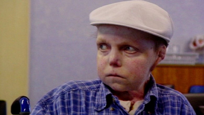 кадр из фильма The Boy Whose Skin Fell Off