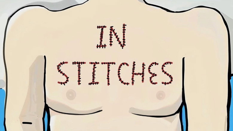 кадр из фильма Liam Nelson - In Stitches: A Post-Op Comedy Special (How to Get Open Heart Surgery)