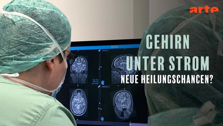 кадр из фильма Gehirn unter Strom - Hilfe bei Depression, Epilepsie und Parkinson?