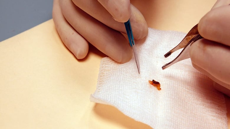 кадр из фильма Patient Seventeen